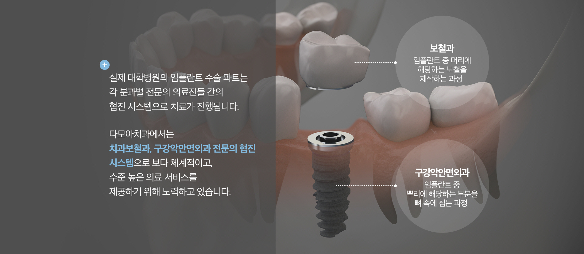 임플란트 클리닉