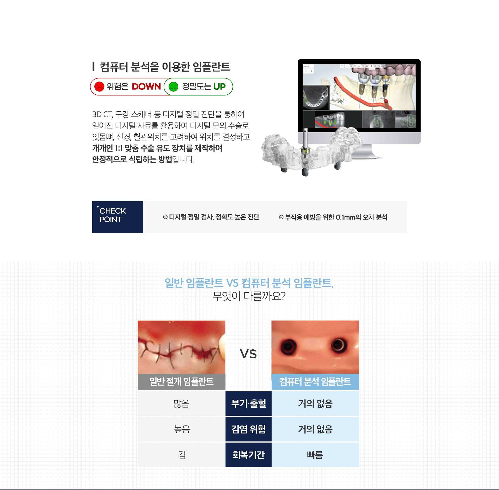 임플란트 클리닉